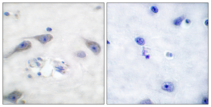 PPP1R1B / DARPP-32 Antibody - Immunohistochemistry analysis of paraffin-embedded human brain tissue, using DARPP-32 Antibody. The picture on the right is blocked with the synthesized peptide.