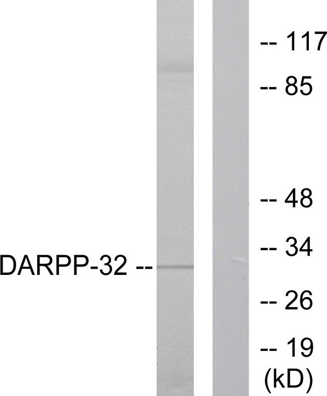 PPP1R1B / DARPP-32 Antibody - Western blot analysis of lysates from 293 cells, treated with EGF 200ng/ml 30', using DARPP-32 Antibody. The lane on the right is blocked with the synthesized peptide.
