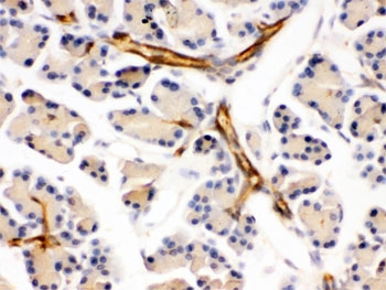 PPP1R1B / DARPP-32 Antibody