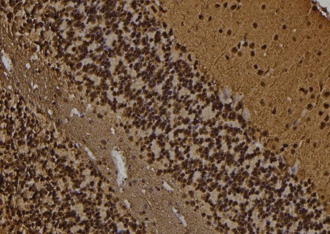 PPP1R1B / DARPP-32 Antibody - 1:100 staining rat brain tissue by IHC-P. The sample was formaldehyde fixed and a heat mediated antigen retrieval step in citrate buffer was performed. The sample was then blocked and incubated with the antibody for 1.5 hours at 22°C. An HRP conjugated goat anti-rabbit antibody was used as the secondary.