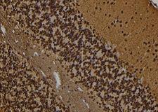 PPP1R1B / DARPP-32 Antibody - 1:100 staining rat brain tissue by IHC-P. The sample was formaldehyde fixed and a heat mediated antigen retrieval step in citrate buffer was performed. The sample was then blocked and incubated with the antibody for 1.5 hours at 22°C. An HRP conjugated goat anti-rabbit antibody was used as the secondary.