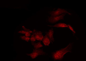 PPP1R1B / DARPP-32 Antibody - Staining COS7 cells by IF/ICC. The samples were fixed with PFA and permeabilized in 0.1% Triton X-100, then blocked in 10% serum for 45 min at 25°C. The primary antibody was diluted at 1:200 and incubated with the sample for 1 hour at 37°C. An Alexa Fluor 594 conjugated goat anti-rabbit IgG (H+L) Ab, diluted at 1/600, was used as the secondary antibody.