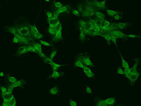 PPP1R1B / DARPP-32 Antibody - Immunofluorescence staining of PPP1R1B in A431 cells. Cells were fixed with 4% PFA, permeabilzed with 0.1% Triton X-100 in PBS, blocked with 10% serum, and incubated with rabbit anti-Human PPP1R1B polyclonal antibody (dilution ratio 1:100) at 4°C overnight. Then cells were stained with the Alexa Fluor 488-conjugated Goat Anti-rabbit IgG secondary antibody (green). Positive staining was localized to Cytoplasm.