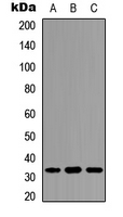 PPP1R1B / DARPP-32 Antibody - Western blot analysis of DARPP32 (pT34) expression in human brain (A); NIH3T3 (B); rat muscle (C) whole cell lysates.