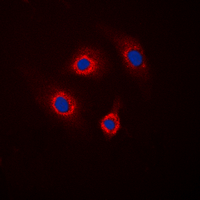 PPP1R1B / DARPP-32 Antibody - Immunofluorescent analysis of DARPP32 (pT34) staining in HepG2 cells. Formalin-fixed cells were permeabilized with 0.1% Triton X-100 in TBS for 5-10 minutes and blocked with 3% BSA-PBS for 30 minutes at room temperature. Cells were probed with the primary antibody in 3% BSA-PBS and incubated overnight at 4 deg C in a humidified chamber. Cells were washed with PBST and incubated with a DyLight 594-conjugated secondary antibody (red) in PBS at room temperature in the dark. DAPI was used to stain the cell nuclei (blue).