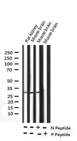 PPP1R1B / DARPP-32 Antibody - Western blot analysis of Phospho-DARPP-32 (Thr34) expression in various lysates