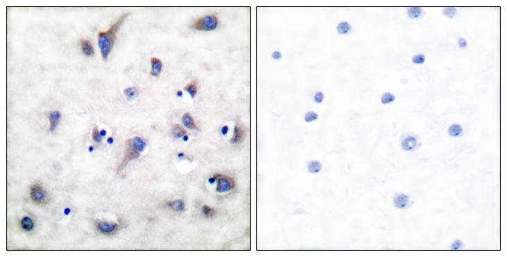 PPP1R1B / DARPP-32 Antibody - P-peptide - + Immunohistochemistry analysis of paraffin-embedded human brain tissue using DARPP-32 (Phospho-Thr34) antibody.