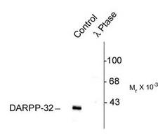 PPP1R1B / DARPP-32 Antibody - Western blot of rat caudate lysate showing specific immunolabeling of the ~32k DARPP-32 phosphorylated at Thr75 (Control). The phosphospecificity of this labeling is shown in the second lane (lambda-phosphatase: lambda phosphatase). The blot is identical