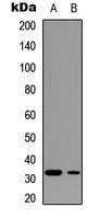 PPP1R1B / DARPP-32 Antibody - Western blot analysis of DARPP32 (pT75) expression in MDA-MB-361 (A); SHSY5Y (B) whole cell lysates.