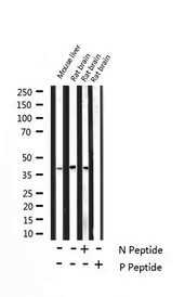 PPP1R1B / DARPP-32 Antibody - Western blot analysis of Phospho-DARPP-32 (Thr75) expression in various lysates