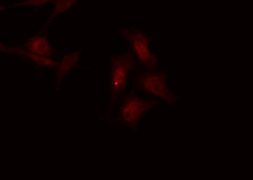 PPP1R1B / DARPP-32 Antibody - Staining HeLa cells by IF/ICC. The samples were fixed with PFA and permeabilized in 0.1% Triton X-100, then blocked in 10% serum for 45 min at 25°C. The primary antibody was diluted at 1:200 and incubated with the sample for 1 hour at 37°C. An Alexa Fluor 594 conjugated goat anti-rabbit IgG (H+L) Ab, diluted at 1/600, was used as the secondary antibody.