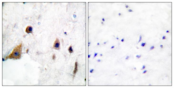 PPP1R1B / DARPP-32 Antibody - P-peptide - + Immunohistochemical analysis of paraffin-embedded human brain tissue using DARPP-32 (phospho-Thr75) antibody.