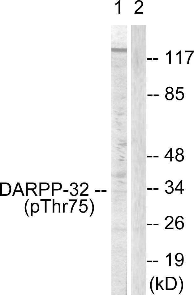 PPP1R1B / DARPP-32 Antibody - Western blot analysis of extracts from COS7 cells treated with Forskolin (40nM, 30mins), using DARPP-32 (phospho-Thr75) antibody.