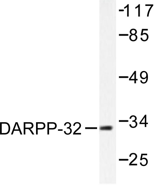 PPP1R1B / DARPP-32 Antibody - Western blot of DARPP-32 (P69) pAb in extracts from 293 cells treated with EGF 200ng/ml 30' or HeLa cells treated with EGF 200ng/ml 5'.