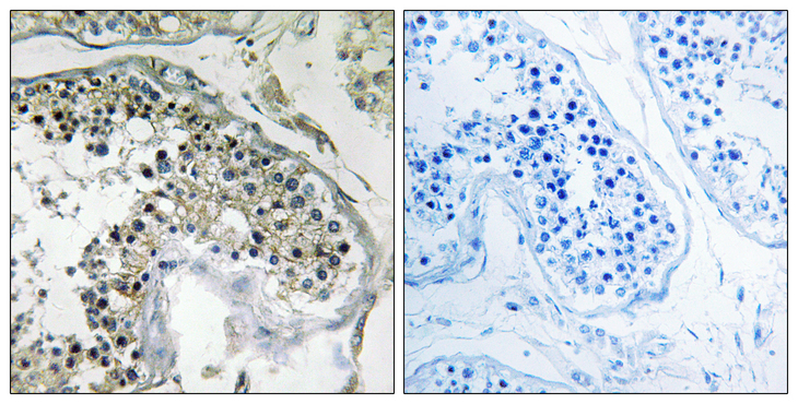 PPP1R1C Antibody - Immunohistochemistry analysis of paraffin-embedded human testis tissue, using PPP1R1C Antibody. The picture on the right is blocked with the synthesized peptide.