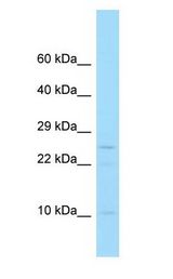 PPP1R1C Antibody - PPP1R1C antibody Western Blot of U937 Whole Cell lysates. Antibody Dilution: 1.0 ug/ml. Antibody dilution: 1 ug/ml.  This image was taken for the unconjugated form of this product. Other forms have not been tested.