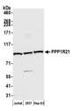 PPP1R21 / KLRAQ1 Antibody - Detection of human PPP1R21 by western blot. Samples: Whole cell lysate (50 µg) from Jurkat, HEK293T, and Hep-G2 cells prepared using NETN lysis buffer. Antibody: Affinity purified rabbit anti-PPP1R21 antibody used for WB at 1:1000. Detection: Chemiluminescence with an exposure time of 30 seconds.