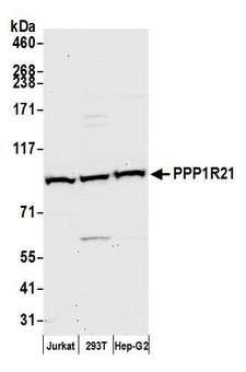 PPP1R21 / KLRAQ1 Antibody - Detection of human PPP1R21 by western blot. Samples: Whole cell lysate (50 µg) from Jurkat, HEK293T, and Hep-G2 cells prepared using NETN lysis buffer. Antibody: Affinity purified rabbit anti-PPP1R21 antibody used for WB at 1:1000. Detection: Chemiluminescence with an exposure time of 30 seconds.