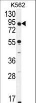 PPP1R21 / KLRAQ1 Antibody - KLRAQ1 Antibody western blot of K562 cell line lysates (35 ug/lane). The KLRAQ1 antibody detected the KLRAQ1 protein (arrow).