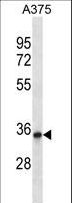 PPP1R27 / DYSFIP1 Antibody - DYSFIP1 Antibody western blot of A375 cell line lysates (35 ug/lane). The DYSFIP1 antibody detected the DYSFIP1 protein (arrow).