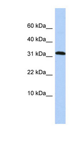 PPP1R27 / DYSFIP1 Antibody - DYSFIP1 antibody Western blot of HepG2 cell lysate. This image was taken for the unconjugated form of this product. Other forms have not been tested.