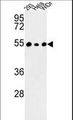 PPP1R36 / C14orf50 Antibody - Western blot of C14orf50 Antibody in 293, HeLa, WiDr cell line lysates (35 ug/lane). C14orf50 (arrow) was detected using the purified antibody.