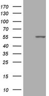 PPP1R36 / C14orf50 Antibody - HEK293T cells were transfected with the pCMV6-ENTRY control. (Left lane) or pCMV6-ENTRY PPP1R36. (Right lane) cDNA for 48 hrs and lysed. Equivalent amounts of cell lysates. (5 ug per lane) were separated by SDS-PAGE and immunoblotted with anti-PPP1R36. (1:2000)