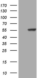 PPP1R36 / C14orf50 Antibody - HEK293T cells were transfected with the pCMV6-ENTRY control. (Left lane) or pCMV6-ENTRY PPP1R36. (Right lane) cDNA for 48 hrs and lysed