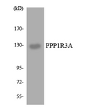 PPP1R3A / GM Antibody - Western blot analysis of the lysates from HT-29 cells using PPP1R3A antibody.