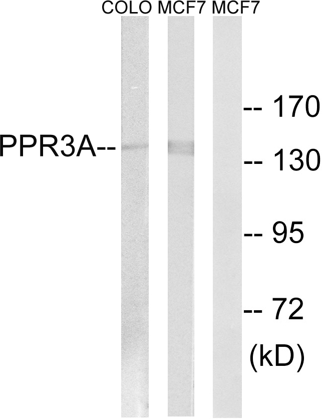 PPP1R3A / GM Antibody - Western blot analysis of lysates from MCF-7 and COLO cells, using PPP1R3A Antibody. The lane on the right is blocked with the synthesized peptide.
