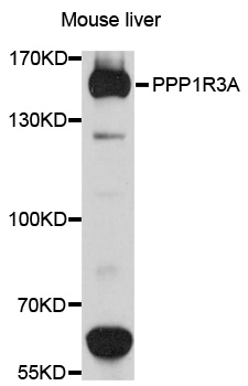 PPP1R3A / GM Antibody - Western blot analysis of extracts of mouse liver, using PPP1R3A antibody at 1:1000 dilution. The secondary antibody used was an HRP Goat Anti-Rabbit IgG (H+L) at 1:10000 dilution. Lysates were loaded 25ug per lane and 3% nonfat dry milk in TBST was used for blocking. An ECL Kit was used for detection and the exposure time was 90s.