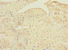 PPP1R3A / GM Antibody - Immunohistochemistry of paraffin-embedded human heart tissue at dilution 1:100