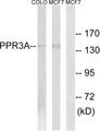 PPP1R3A / GM Antibody - Western blot analysis of extracts from COLO cells and MCF-7 cells, using PPP1R3A antibody.