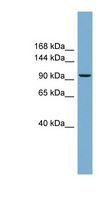 PPP1R3A / GM Antibody - PPP1R3A antibody Western blot of THP-1 cell lysate. This image was taken for the unconjugated form of this product. Other forms have not been tested.
