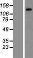 PPP1R3A / GM Protein - Western validation with an anti-DDK antibody * L: Control HEK293 lysate R: Over-expression lysate
