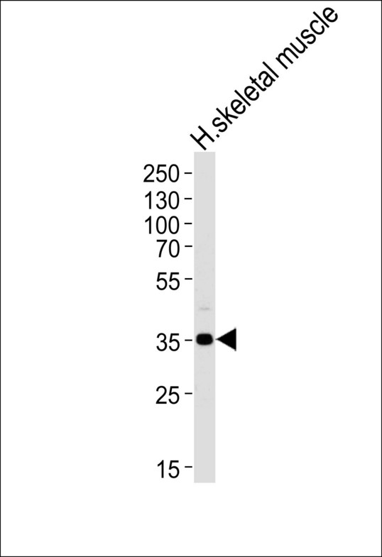 PPP1R3B Antibody - Western blot of lysate from human skeletal muscle tissue lysate, using PPP1R3B Antibody. Antibody was diluted at 1:1000 at each lane. A goat anti-rabbit IgG H&L (HRP) at 1:5000 dilution was used as the secondary antibody. Lysate at 35ug per lane.