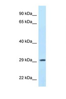 PPP1R3B Antibody - PPP1R3B antibody Western blot of MCF7 Cell lysate. Antibody concentration 1 ug/ml.  This image was taken for the unconjugated form of this product. Other forms have not been tested.