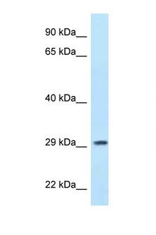 PPP1R3B Antibody - PPP1R3B antibody Western blot of MCF7 Cell lysate. Antibody concentration 1 ug/ml.  This image was taken for the unconjugated form of this product. Other forms have not been tested.