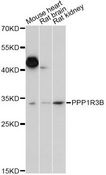PPP1R3B Antibody - Western blot analysis of extracts of various cell lines, using PPP1R3B antibody at 1:1000 dilution. The secondary antibody used was an HRP Goat Anti-Rabbit IgG (H+L) at 1:10000 dilution. Lysates were loaded 25ug per lane and 3% nonfat dry milk in TBST was used for blocking. An ECL Kit was used for detection and the exposure time was 15s.
