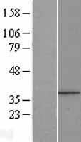 PPP1R3B Protein - Western validation with an anti-DDK antibody * L: Control HEK293 lysate R: Over-expression lysate