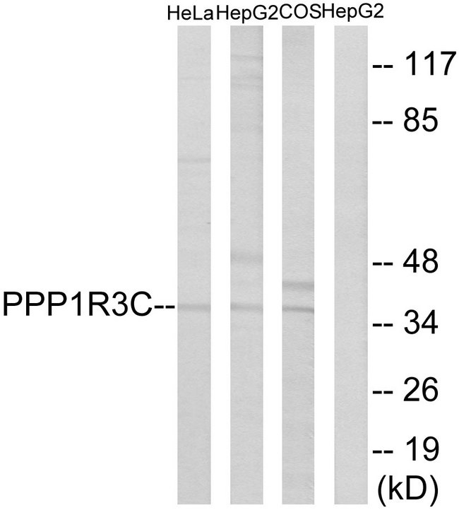 PPP1R3C / PTG Antibody - Western blot analysis of lysates from HepG2, HeLa, and COS7 cells, using PPP1R3C Antibody. The lane on the right is blocked with the synthesized peptide.