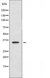 PPP1R3C / PTG Antibody - Western blot analysis of extracts of HeLa cells using PPP1R3C antibody.