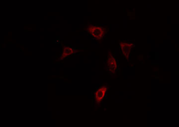 PPP1R3C / PTG Antibody - Staining HepG2 cells by IF/ICC. The samples were fixed with PFA and permeabilized in 0.1% Triton X-100, then blocked in 10% serum for 45 min at 25°C. The primary antibody was diluted at 1:200 and incubated with the sample for 1 hour at 37°C. An Alexa Fluor 594 conjugated goat anti-rabbit IgG (H+L) antibody, diluted at 1/600, was used as secondary antibody.