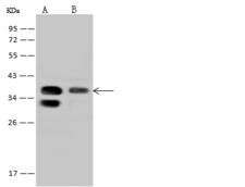PPP1R3C / PTG Antibody - Anti-PPP1R3C rabbit polyclonal antibody at 1:500 dilution. Lane A: Mouse kidney tissue lysate. Lane B: U-251 MG Whole Cell Lysate. Lysates/proteins at 30 ug per lane. Secondary: Goat Anti-Rabbit IgG (H+L)/HRP at 1/10000 dilution. Developed using the ECL technique. Performed under reducing conditions. Predicted band size: 37 kDa. Observed band size: 37 kDa.