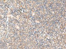 PPP1R3C / PTG Antibody - Immunohistochemistry of paraffin-embedded Human tonsil tissue  using PPP1R3C Polyclonal Antibody at dilution of 1:50(×200)