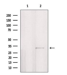PPP1R3D Antibody - Western blot analysis of extracts of HepG2 cells using PPP1R3D antibody. Lane 1 was treated with the blocking peptide.