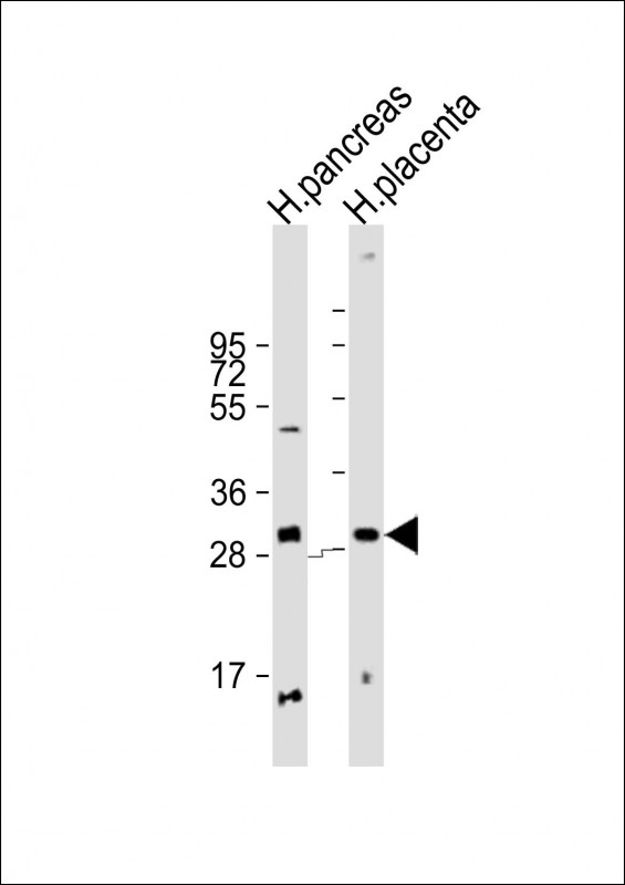 PPP1R3E Antibody - All lanes: Anti-PPP1R3E Antibody (Center) at 1:2000 dilution Lane 1: human pancreas lysate Lane 2: human placenta lysate Lysates/proteins at 20 µg per lane. Secondary Goat Anti-Rabbit IgG, (H+L), Peroxidase conjugated at 1/10000 dilution. Predicted band size: 31 kDa Blocking/Dilution buffer: 5% NFDM/TBST.