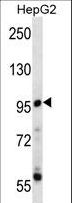 PPP1R3F Antibody - PPP1R3F Antibody western blot of HepG2 cell line lysates (35 ug/lane). The PPP1R3F antibody detected the PPP1R3F protein (arrow).