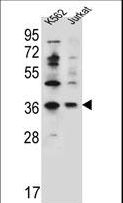 PPP1R3G Antibody - PPP1R3G Antibody western blot of K562,Jurkat cell line lysates (35 ug/lane). The PPP1R3G antibody detected the PPP1R3G protein (arrow).