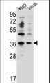 PPP1R3G Antibody - PPP1R3G Antibody western blot of K562,Jurkat cell line lysates (35 ug/lane). The PPP1R3G antibody detected the PPP1R3G protein (arrow).